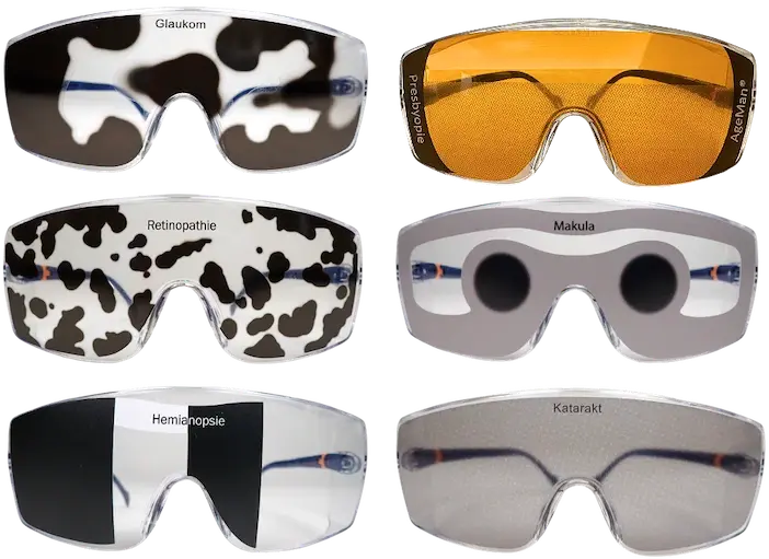 Aging Glasses Simulationsbrillen -Seheinschränkungen, Simulation von Sehbehinderung durch Augenerkrankungen: Hemiparese, Presbyopie, Altersbedingte Makula Degeneration, Glaukom, Katarakt, Retinopathie
